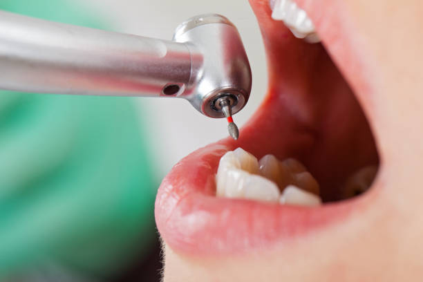 Best Tooth Infection Emergency Dentist  in Bartonville, TX